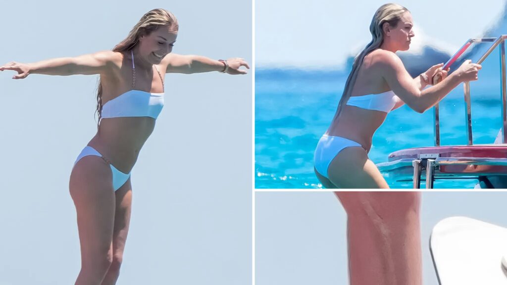 Lindsey Vonn Shows Off Surgery Scars In Bikini